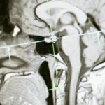 brain diagram aggression