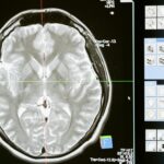 brain scan aggression