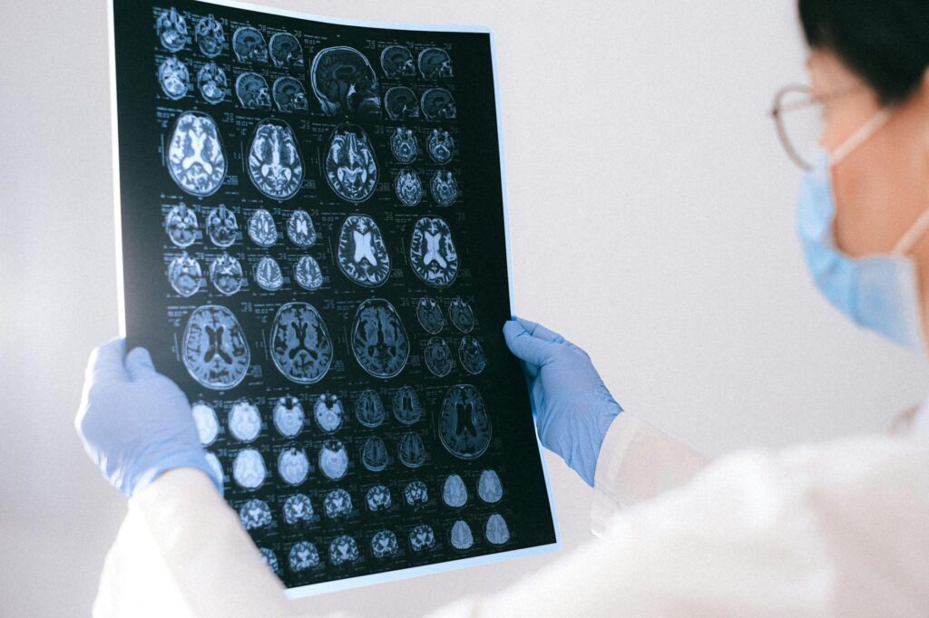 brain scan of psychopathic individual