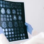 brain scan of psychopathic individual
